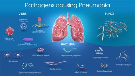 Pneumonia Scientific Animations