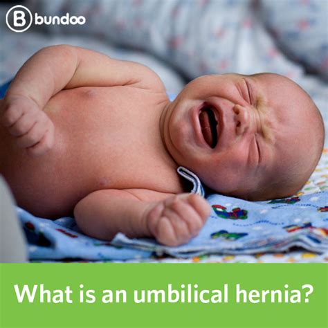 What Is An Umbilical Hernia Shower Thoughts Random Shower Thoughts