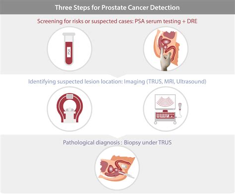 Improving Diagnosis Of Prostate Cancer With Psa Tests Mindray