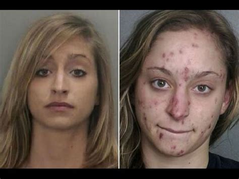 Crystal Meth Before After Photos Its Devastating Effects Youtube