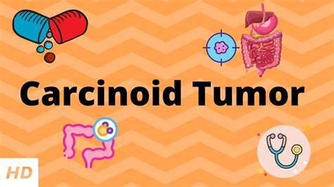 carcinoid tumor causes signs and symptoms diagnosis and treatment youtube
