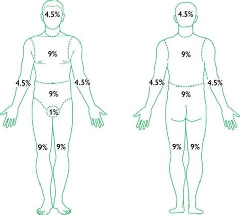 The ' rule of nines' divides the body surface into areas of 9 % or multiples of 9 treatment of burns in tccc. rule of nines | rule_of_nines_2.jpg | Rule of nines ...
