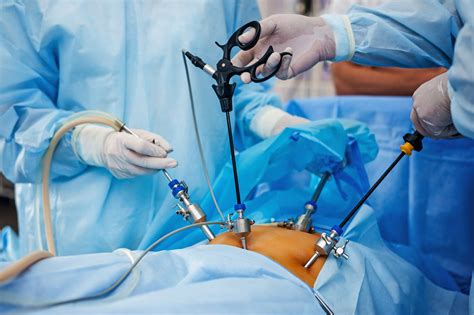 Advantages Of Laparoscopic Surgery Health Flume