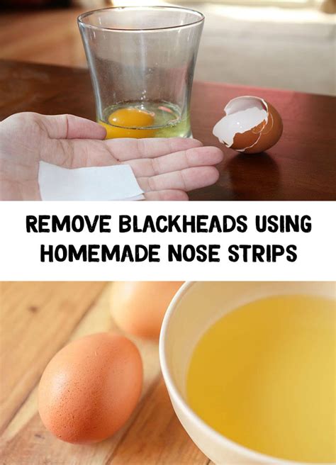 Want to diy yourself a protective face mask? Homemade strip - Remove blackheads using homemade nose strips