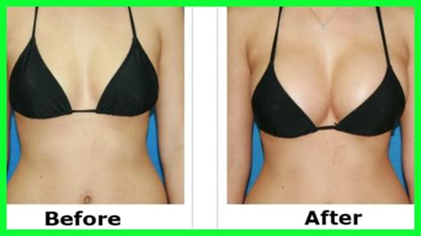 Lift Tighten Prevent Sagging Breasts Firm Sagging Breasts Naturally
