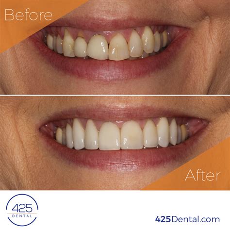 Before And After 425 Dental