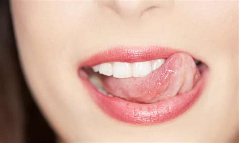 Five Ways To Cure And Prevent Chapped Lips Health And Wellbeing The