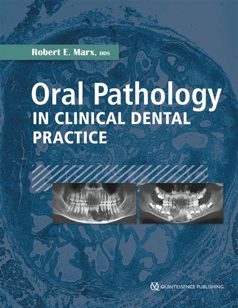 Robert E Marx Oral Pathology In Clinical Dental Practice