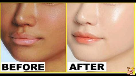 Permanent Skin Whitening Secret For Skin Whitening Fair Skin Radiant