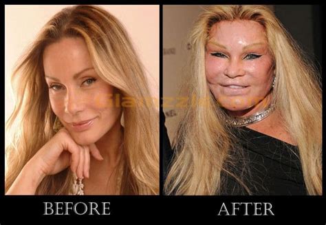 Jocelyn Wildenstein Before And After Plastic Surgery