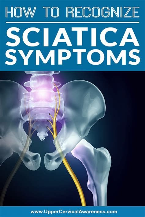 How To Recognize Sciatica Symptoms Upper Cervical Awareness