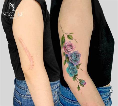 Scar Cover Up Tattoos Help Women Regain Confidence In Their Bodies