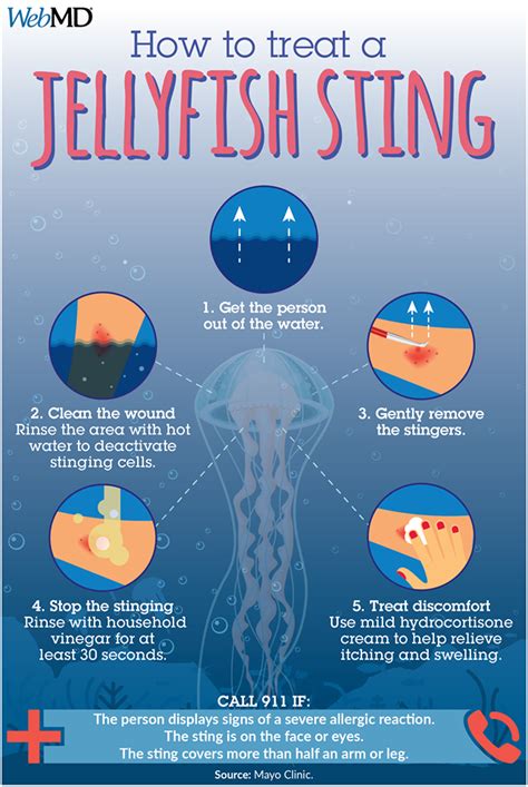 Box Jellyfish Stingwhat To Know