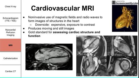 Cardiac Imaging Modalities Youtube
