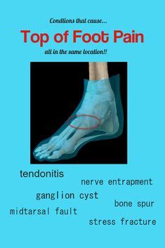 Gradual onset of swelling, bruising as well as pain on top of foot. What Does a Stress Fracture in The Foot Feel Like (With ...