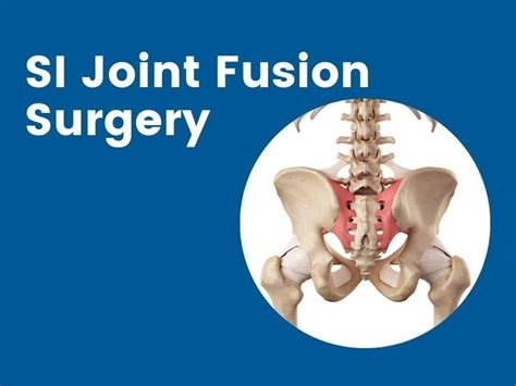 Si Joint Fusion Surgery In Mumbai Cancer Surgery Service Dr Saijyot Raut Best Spine