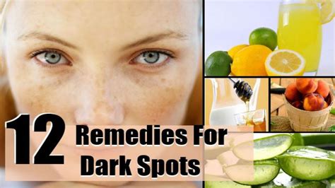 Black Spots On Skin Treatment