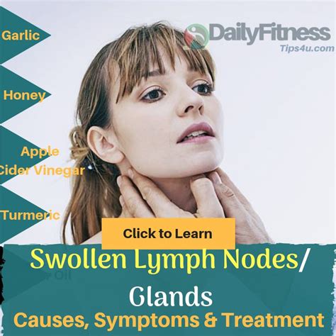Swollen Lymph Nodes 21 Causes Photos And Treatments Images And Photos