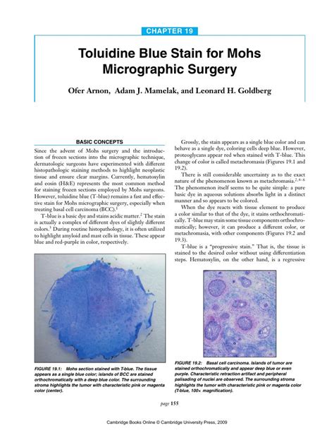 Toluidine Blue Stain For Mohs Micrographic Surgery Chap 19 Mohs