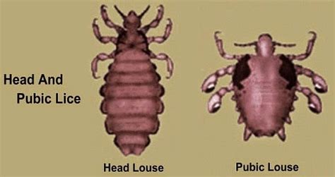 Head Lice And Pubic Lice Health And Medical Information