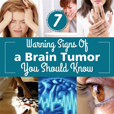 7 Warning Signs Of A Brain Tumor You Should Know With Images Brain Tumor Tumor