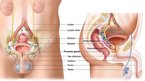 A healthy prostate is about the size of a walnut. What Is Prostate Gland Enlargement? - YouTube