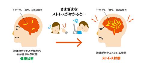 ストレスとは アロパノール 全薬工業株式会社