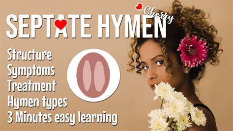 Septate Hymen Structure Causes Symptoms Treatment Types Of Hymen Female Reproductive