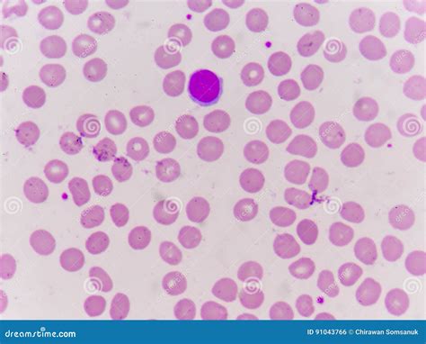Normochromic Normacytic Red Blood Cells Stock Photo Image Of Macro
