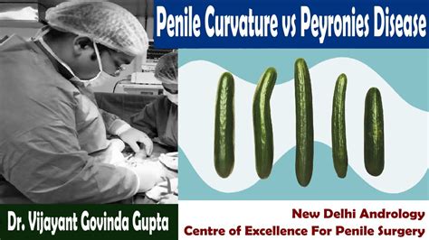 Curved Penis Causes Penile Curvature Vs Peyronies Disease Youtube
