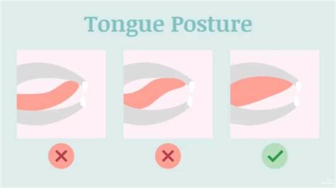 Proper Mewing Tongue Posture Before And After Adopting Correct Resting Tongue Position Teeth