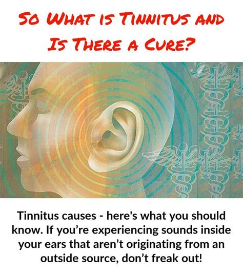 Pin On Tinnitus Causes