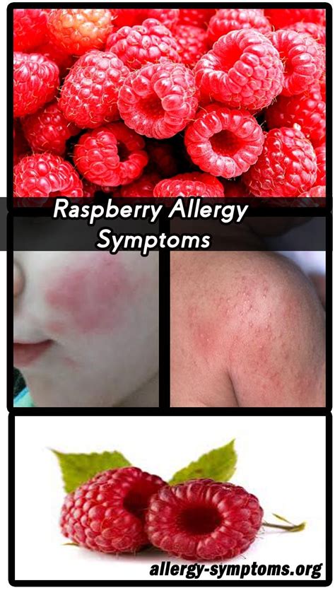 Raspberry Allergy Skin Rash Raspberry