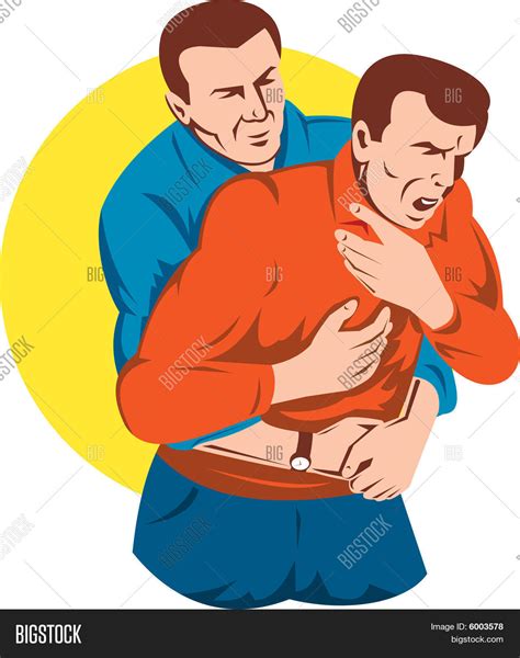 Heimlich Maneuver On Vector And Photo Free Trial Bigstock