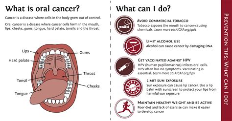 Oral Cancer Screening And Prevention At American Indian Cancer Foundation