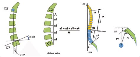 Figure Measurements Of Cervical Alignment Ishihara Index And Spinal