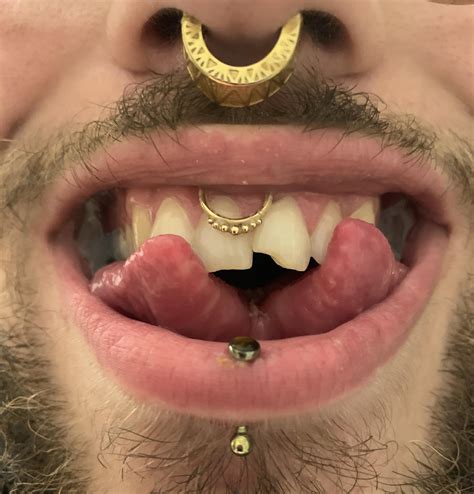 Got My Tongue Split So Happy With How Well Its Healed Rbodymods