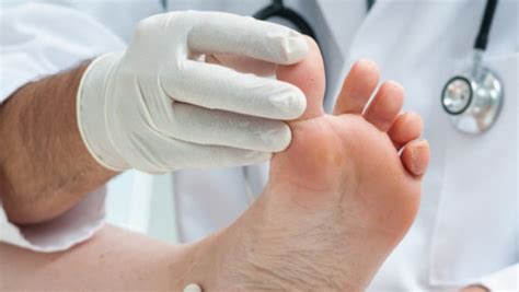 Sprained Toe Causes Symptoms Diagnosis Treatment Prevention