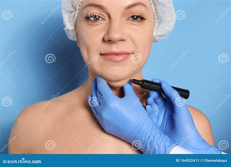Double Chin Lift The Doctor Drew An Outline For Plastic Surgery