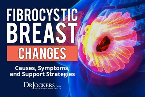 Fibrocystic Breast Changes Causes Symptoms And Strategies