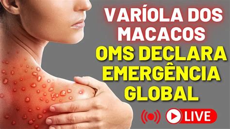 Var Ola Dos Macacos Tudo Que Voc Precisa Saber Sobre A Var Ola Dos