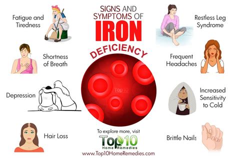 10 Signs And Symptoms Of Iron Deficiency Top 10 Home Remedies