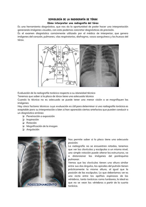 C Mo Interpretar Una Radiografia Del T Rax Semiolog A De La Radiograf A De T Rax C Mo