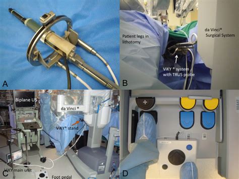 Robotic Transrectal Ultrasonography During Robot Assisted Radical Prostatectomy European Urology