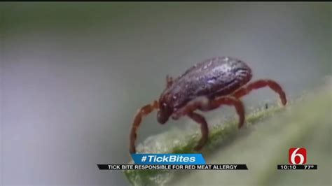 Oklahoma Woman Develops Meat Allergy After Tick Bite