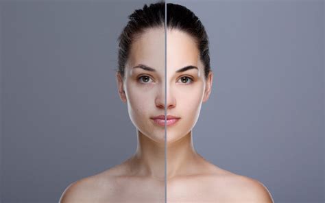 How To Manage An Uneven Skin Tone How To Manage An Uneven Skin Tone