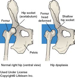 Symptoms and signs of a dislocated hip is acute severe pain in the hip and/or associated structures, an inability to walk or move one's leg, and. Joint Subluxations in Dogs | VCA Animal Hospital