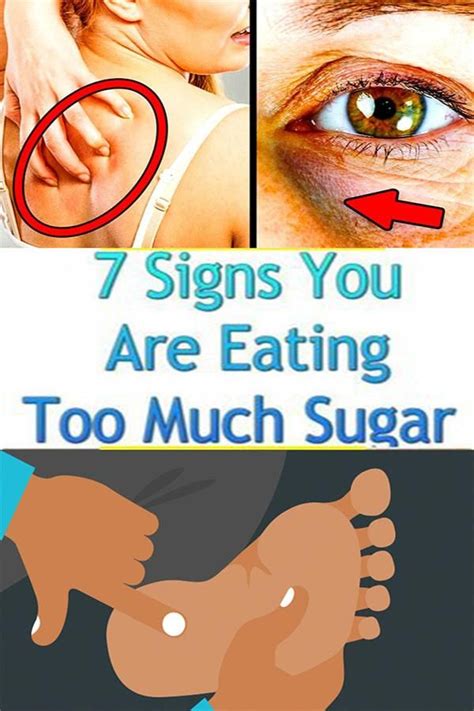 These 7 Signs Indicates You Are Eating Too Much Sugar In 2020 Ate Too
