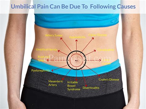 Abdominal Pain Umbilical Area