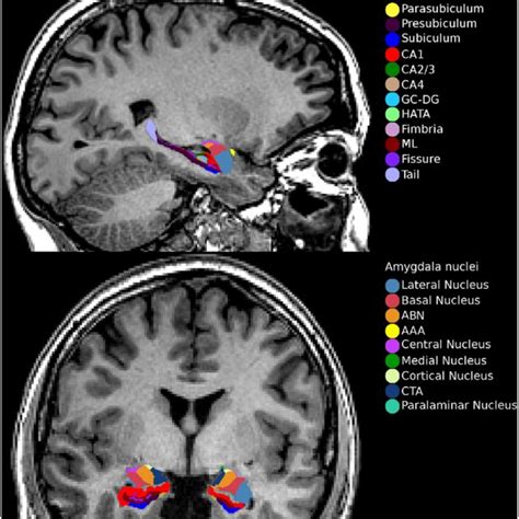 Hippocampal Subfield And Amygdala Nuclei Volume Differences Between Download Scientific Diagram